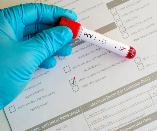 screening HCV